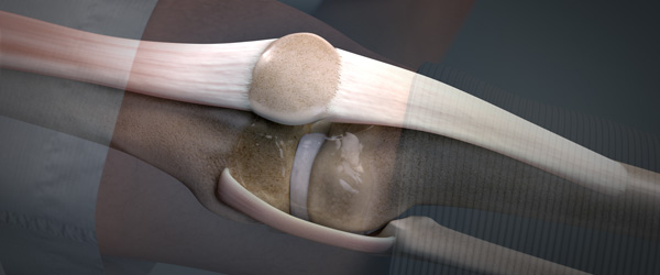 Knee Decompression Animation