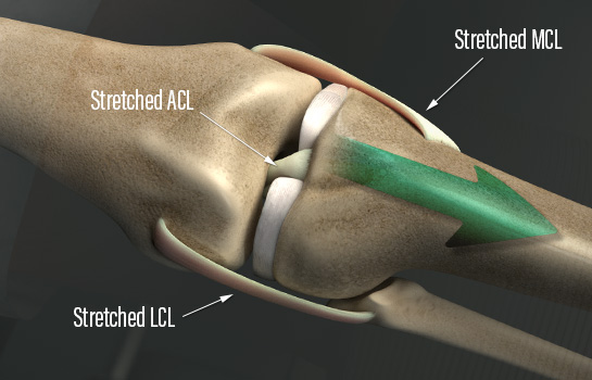 Knee Ligaments
